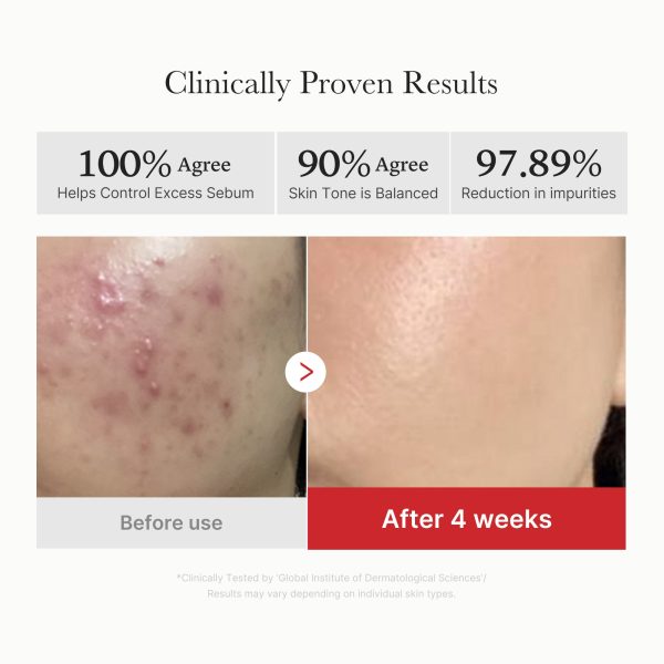 [GIFT] Red Succinic Acid Panthenol Pads