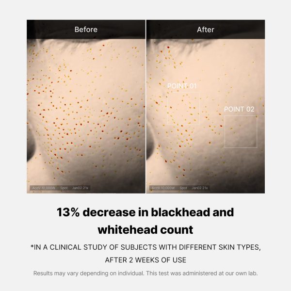 Zero Pore One-day Serum